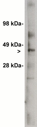 Western blot analysis using Ceramide Glycosyltransferase antibody (X1700P) on 7 ug  of rat kidney lysate.  Antibody used at 1 ug/ml.  Visualized using Pierce West Femto substrate system.  Secondary used at 1:75k dilution.  Exposure for 60 seconds.
